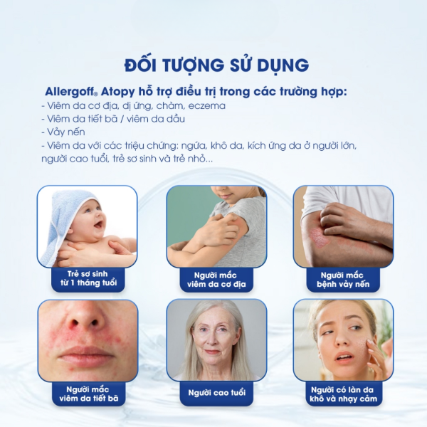 Kem dưỡng ẩm, dịu ngứa Allergoff Atopy - 75ml - Hình ảnh 4